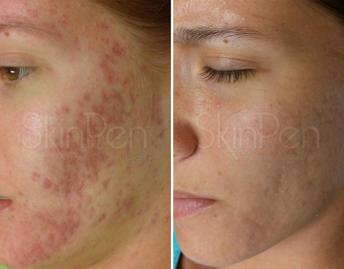 Eternal Skin Care